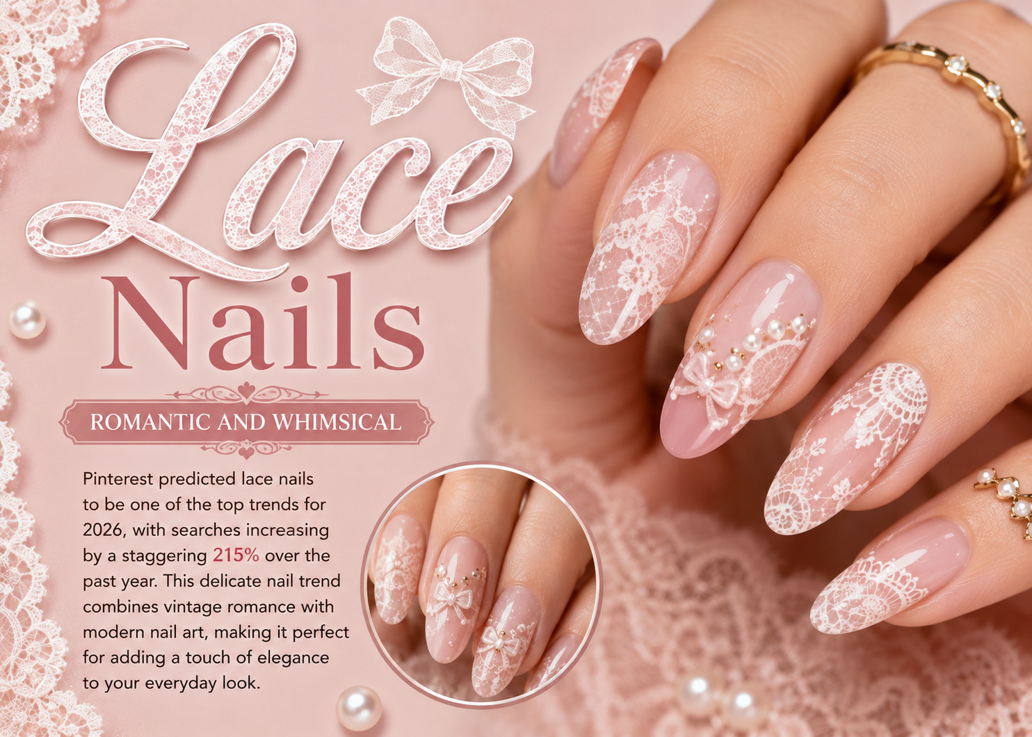 Lace Nails: Romantic and Whimsical